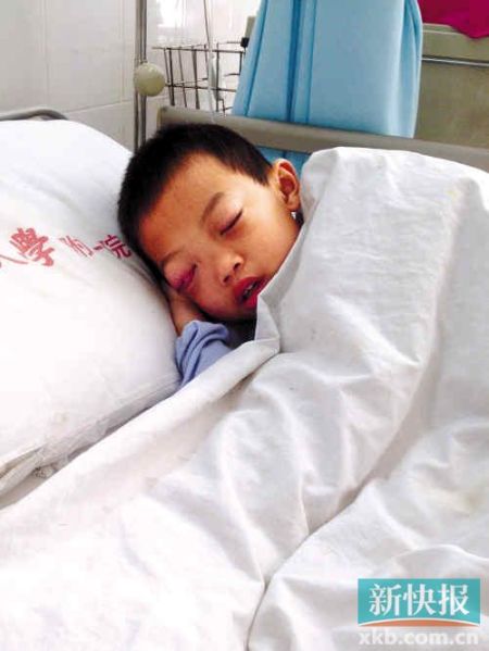 男童眼睛患病被误诊 两次手术后双目失明(图)