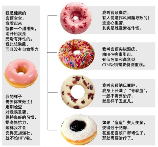 如果把宫颈看成甜甜圈,什么样子的最健康?